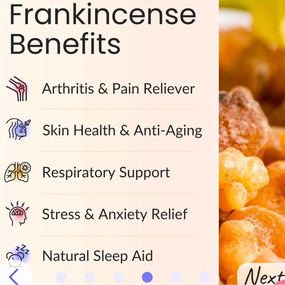 Frankincense Essential Oil 30ml